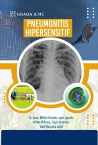Pneumonitis hipersensitif